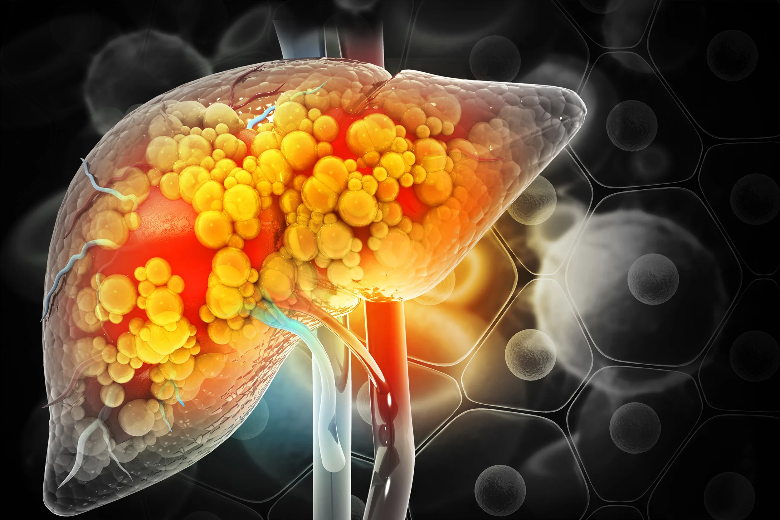 Alcohol Related Liver Disease Soared During Pandemic Harvard Gazette