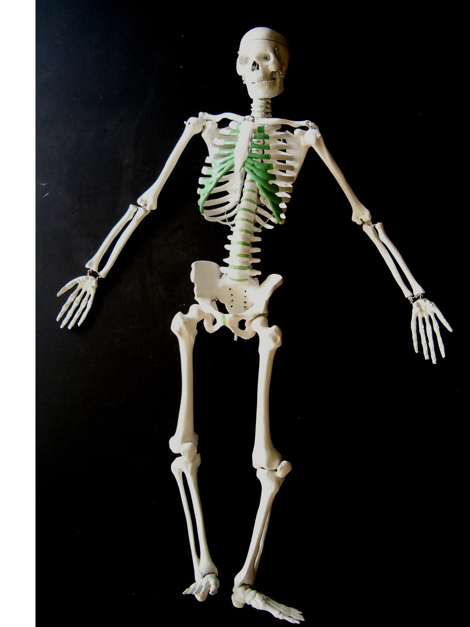 Anatomy