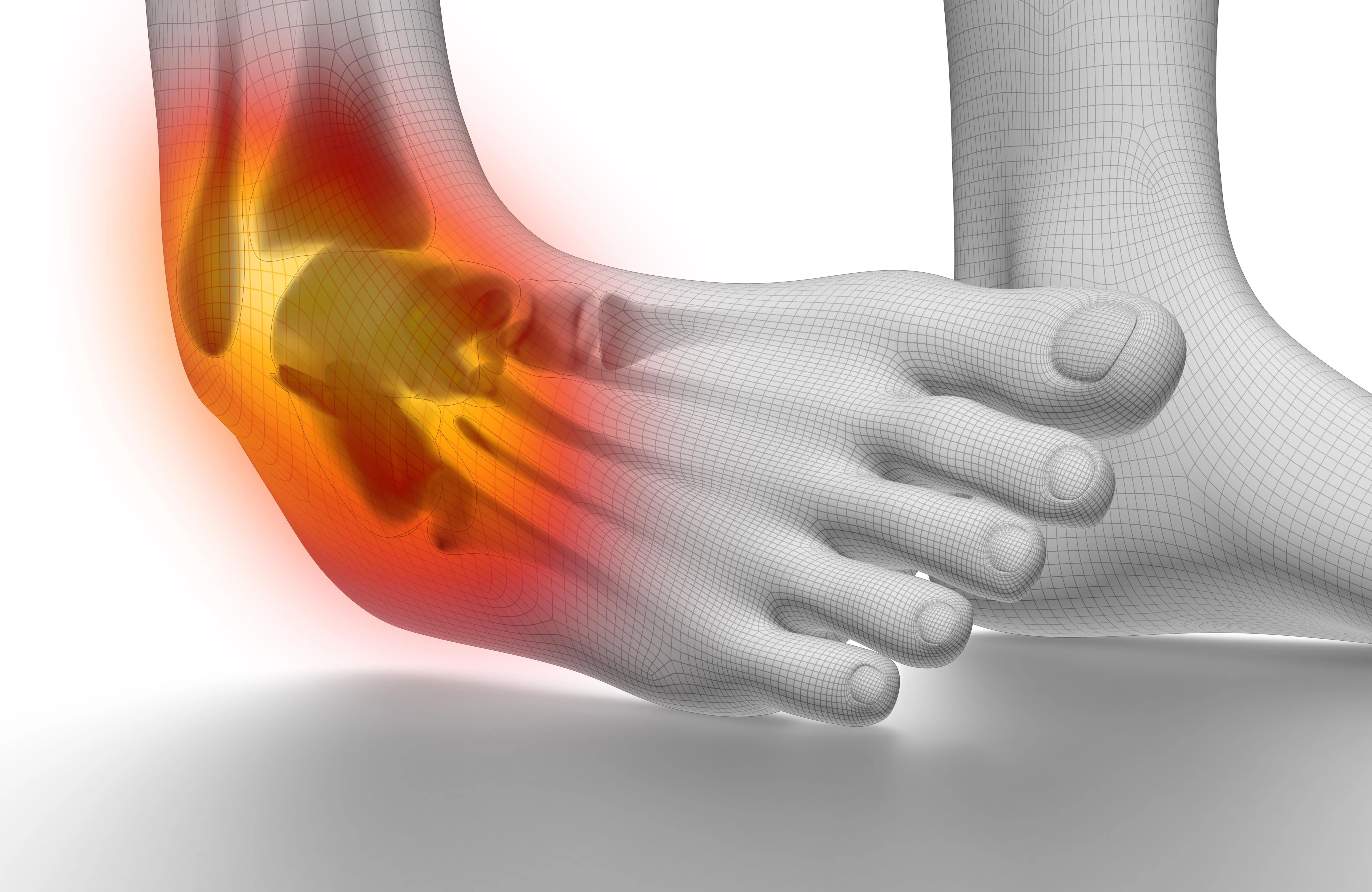 Ankle Sprain Specialist Palm Harbor Fl Orthopedic Specialists Orthopedic Surgeon