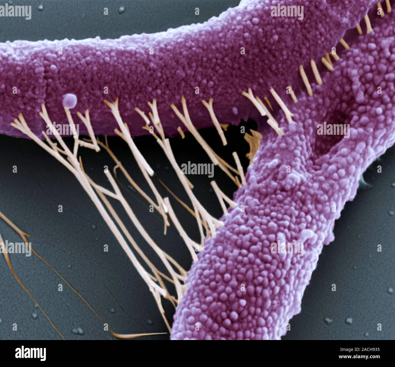 Anthrax Bacteria Coloured Scanning Electron Micrograph Sem Of Bacillus Anthracis Bacteria