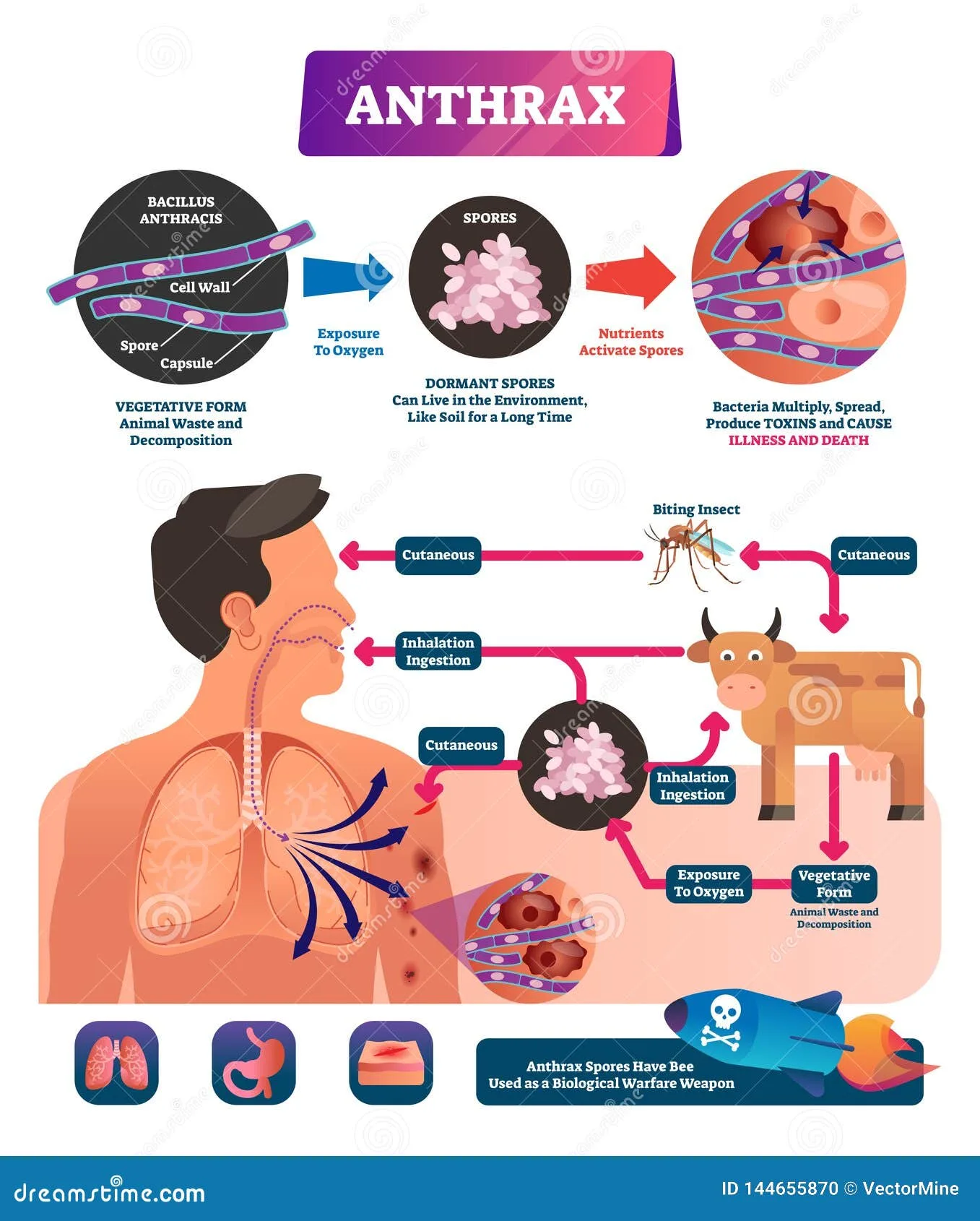 Anthrax Disease