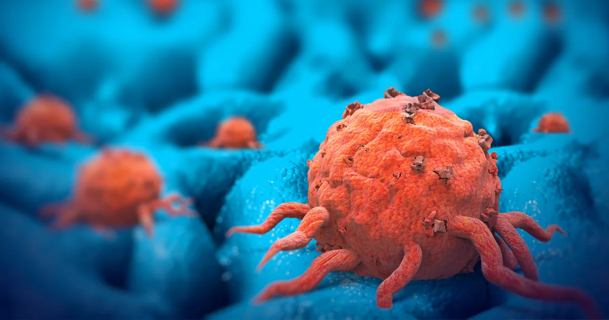 Are Certain Cancer Becoming More Common Ctca
