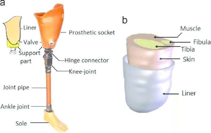 Artificial Limb Stump And Prosthetic Socket A Prosthesis Structure And B Stump And Liner