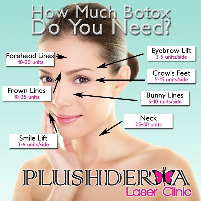 Botox Injection Sites Diagram Google Da Ara Estetik Anatomi