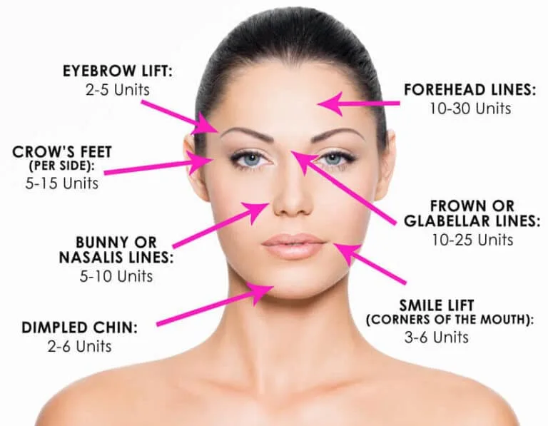 Botox Injection Sites Face Diagram Botox Cosmetic Botox Botox Riset