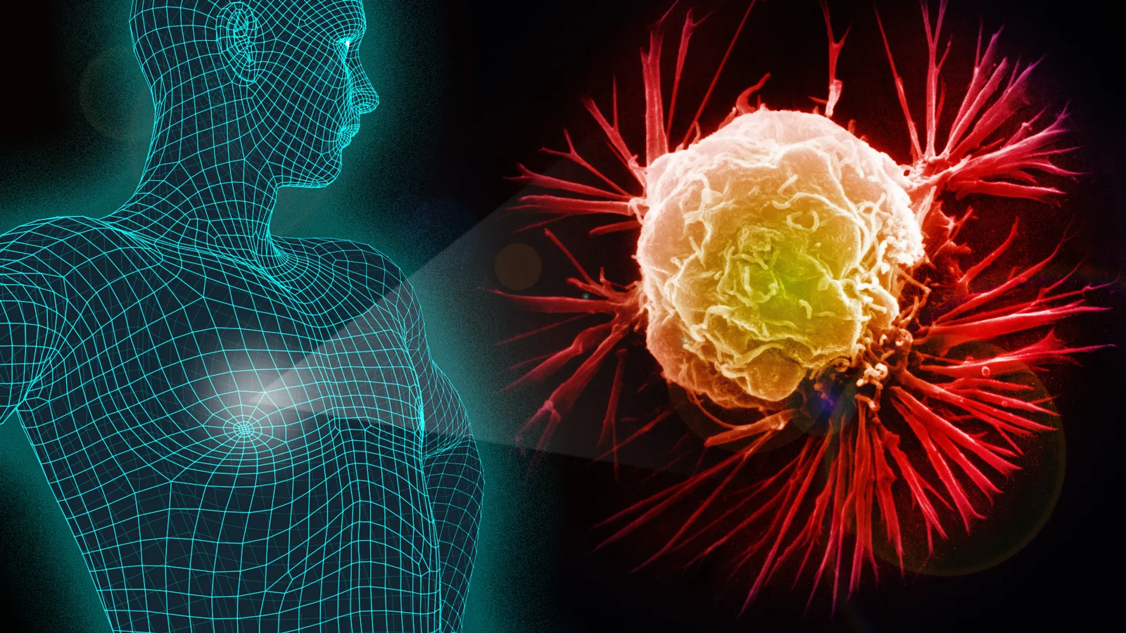 Cancer Faqs Profmoosa