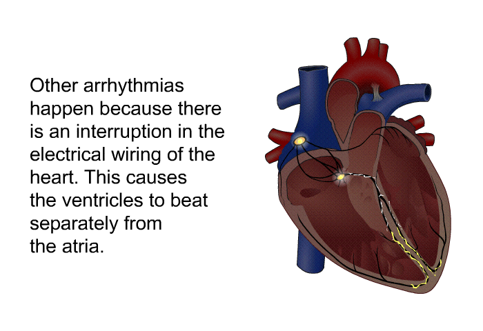 Cardiac Ablation For Atrial Fibrillation