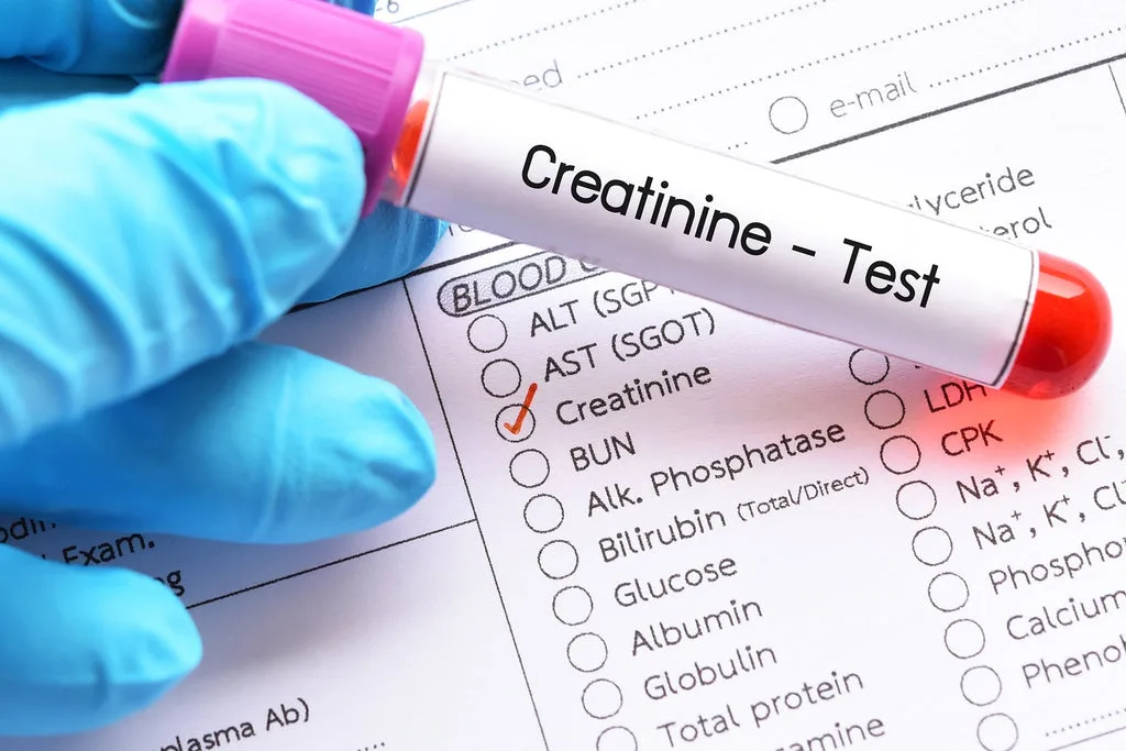 Creatinine Clearance Test Meaning Normal Ranges Kidney Function Mydiagnostics