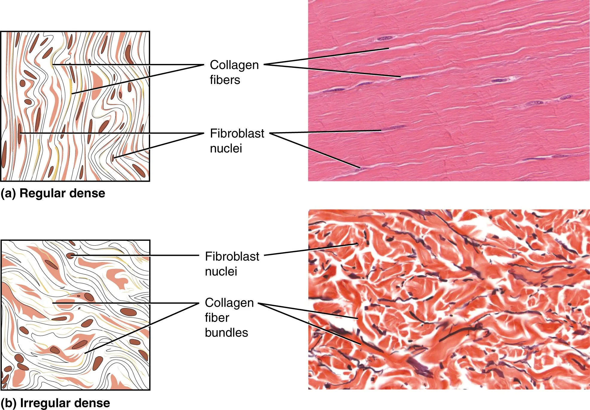 Dense Irregular Connective Tissue Diagram