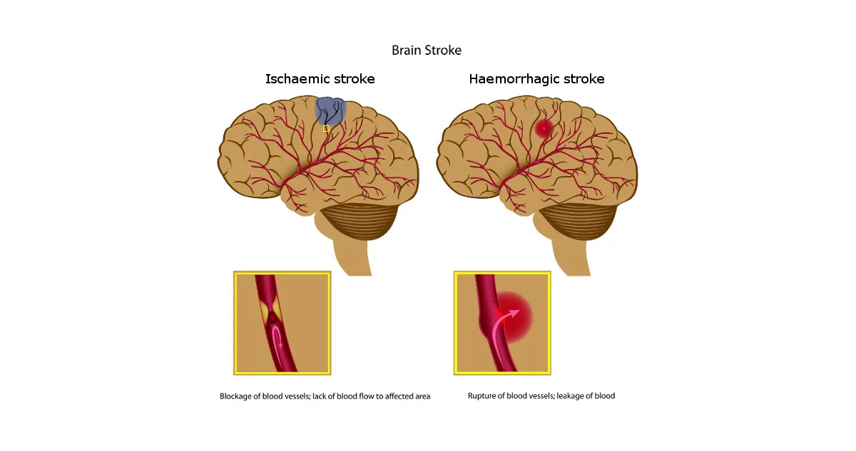 Diagram Engine Stroke Diagram