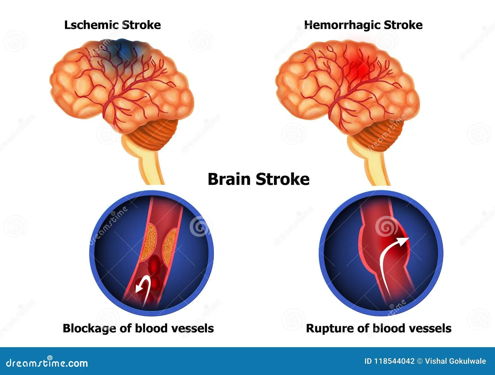 Diagram Engine Stroke Diagram