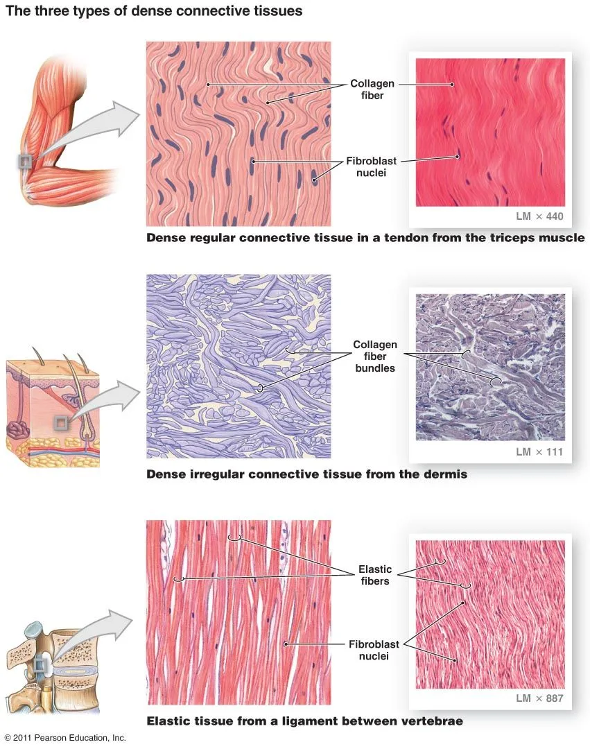 Diagram Of Dense Connective Tissue
