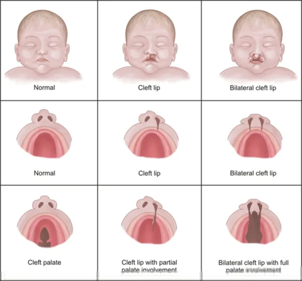 Diagram Synaptic Cleft Diagram