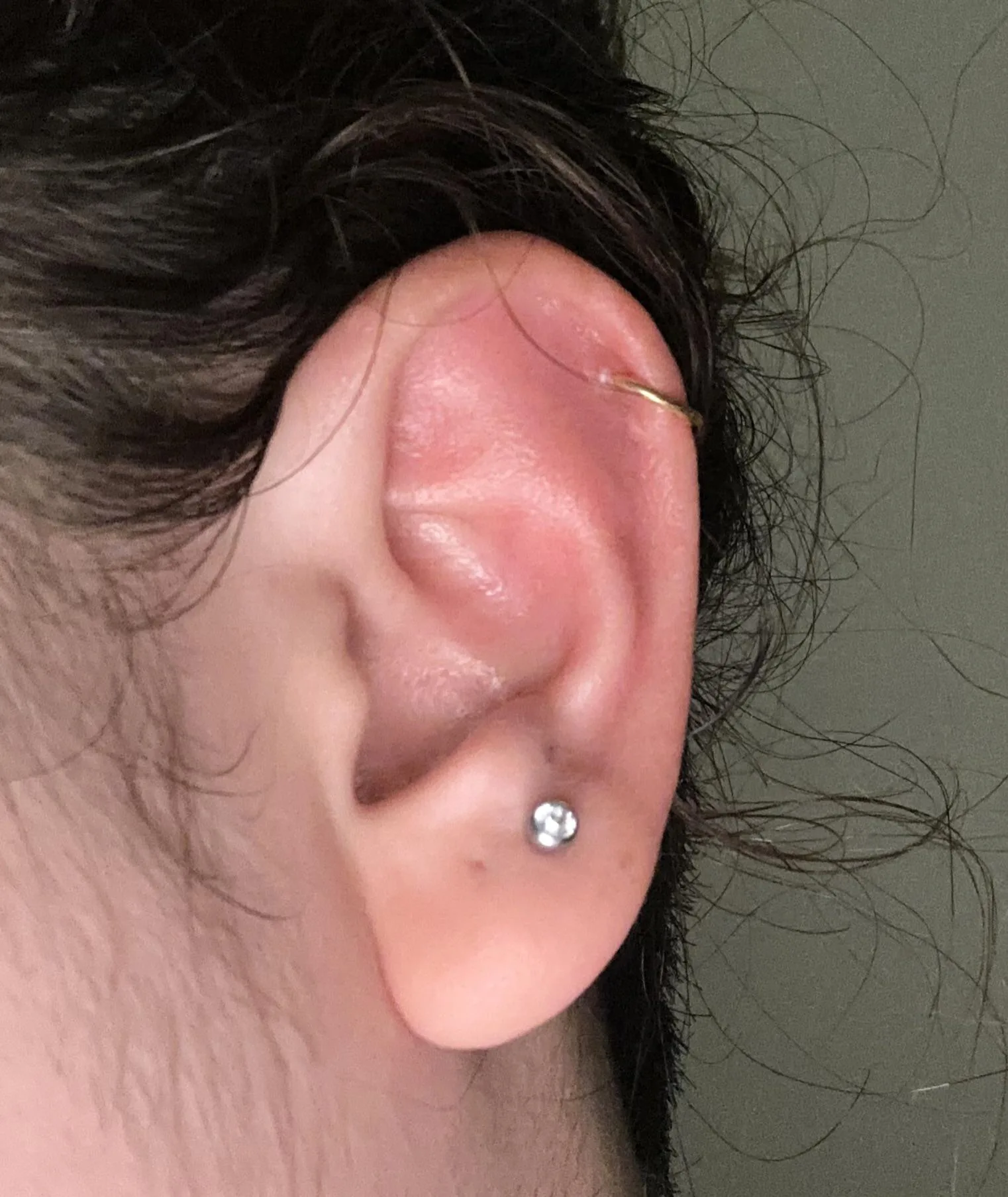 Early Signs Of Infected Helix R Piercing