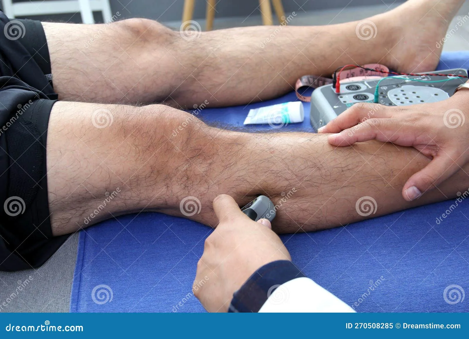 Electromyography Emg And Somatosensory Evoked Potential Pev Of Lower Extremities To Explore The