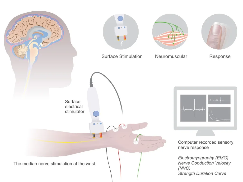 Electromyography Emg Coastal Health Specialty Care
