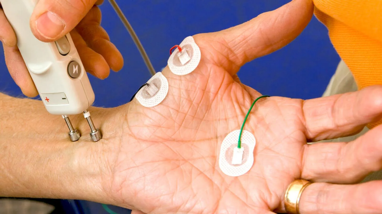 Electromyography Emg Uses Preparation Test Results