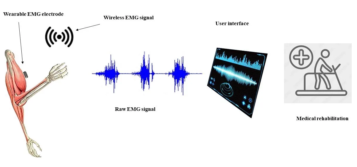 Electromyography