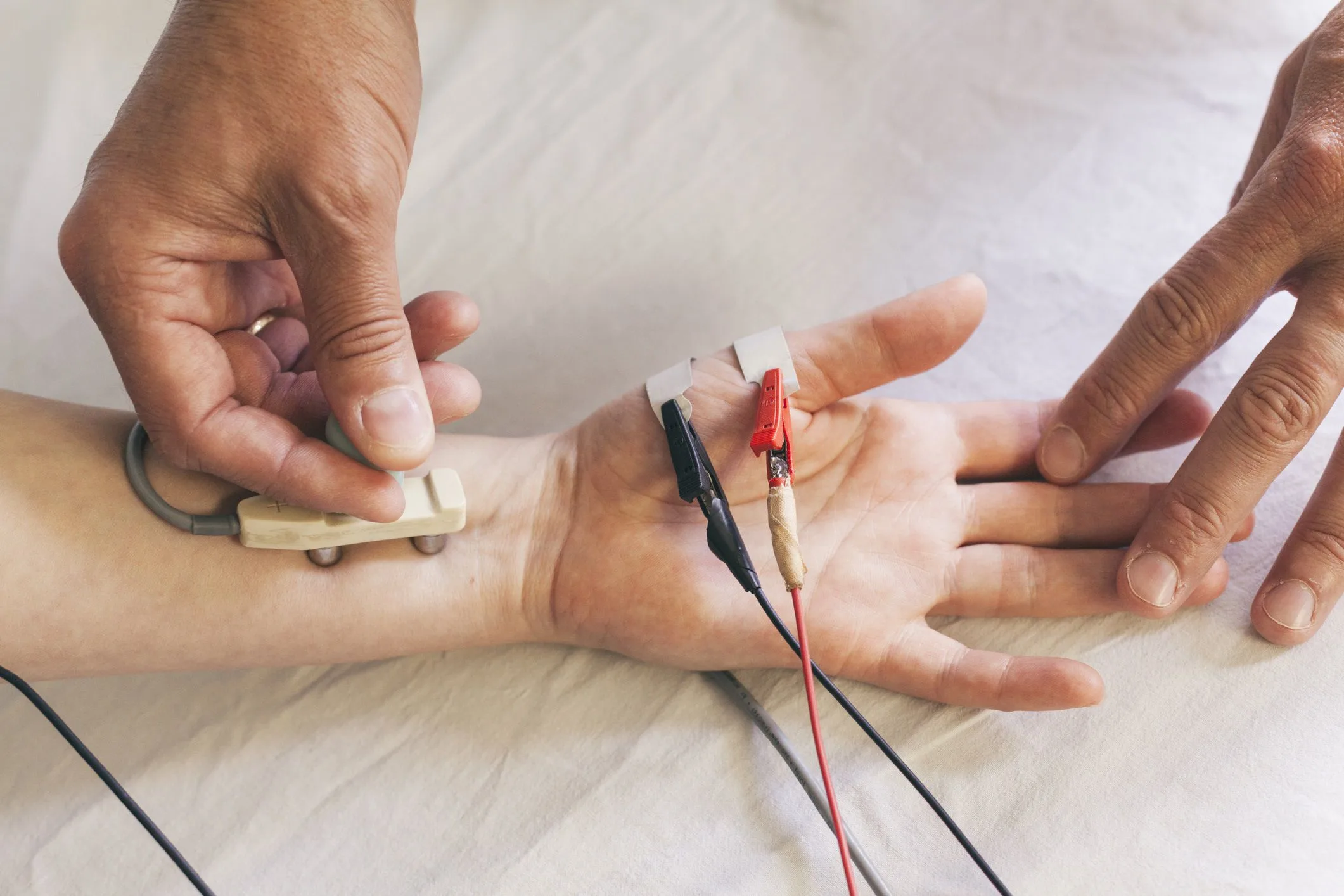 Electromyography Uses Side Effects Procedure Results