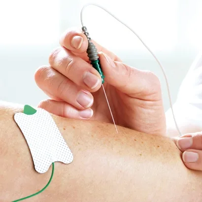 Emg Molecular Scans Chicago