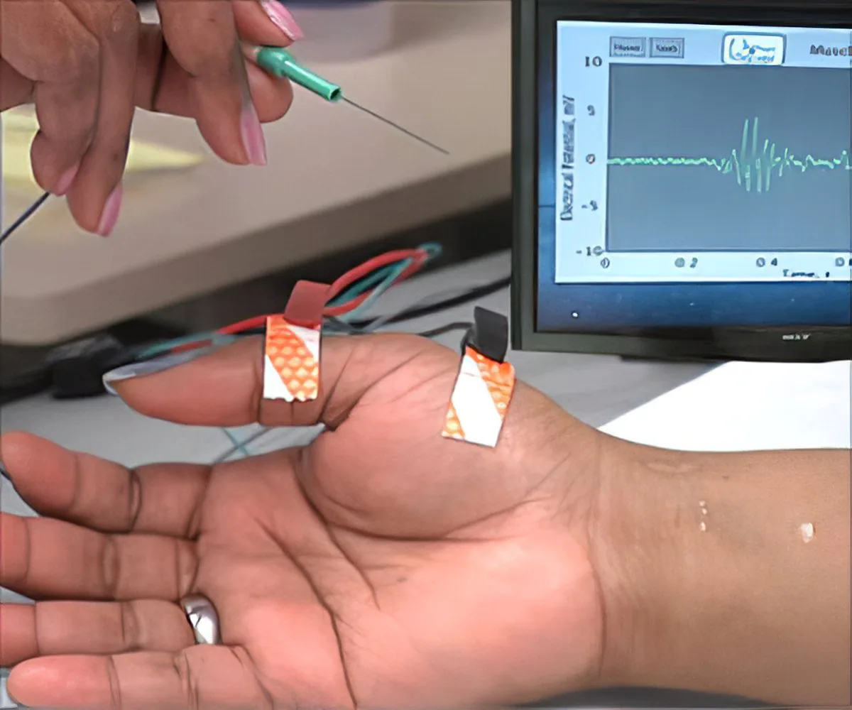 Emg Test Results