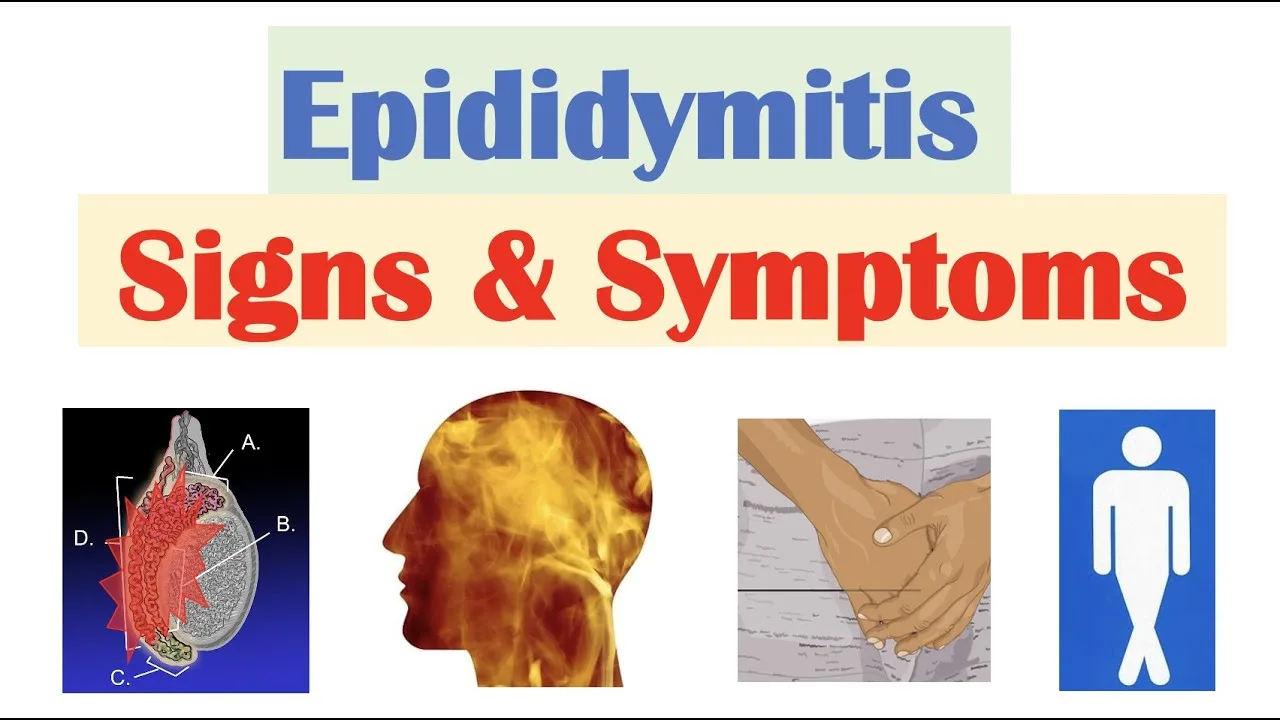 Epididymitis