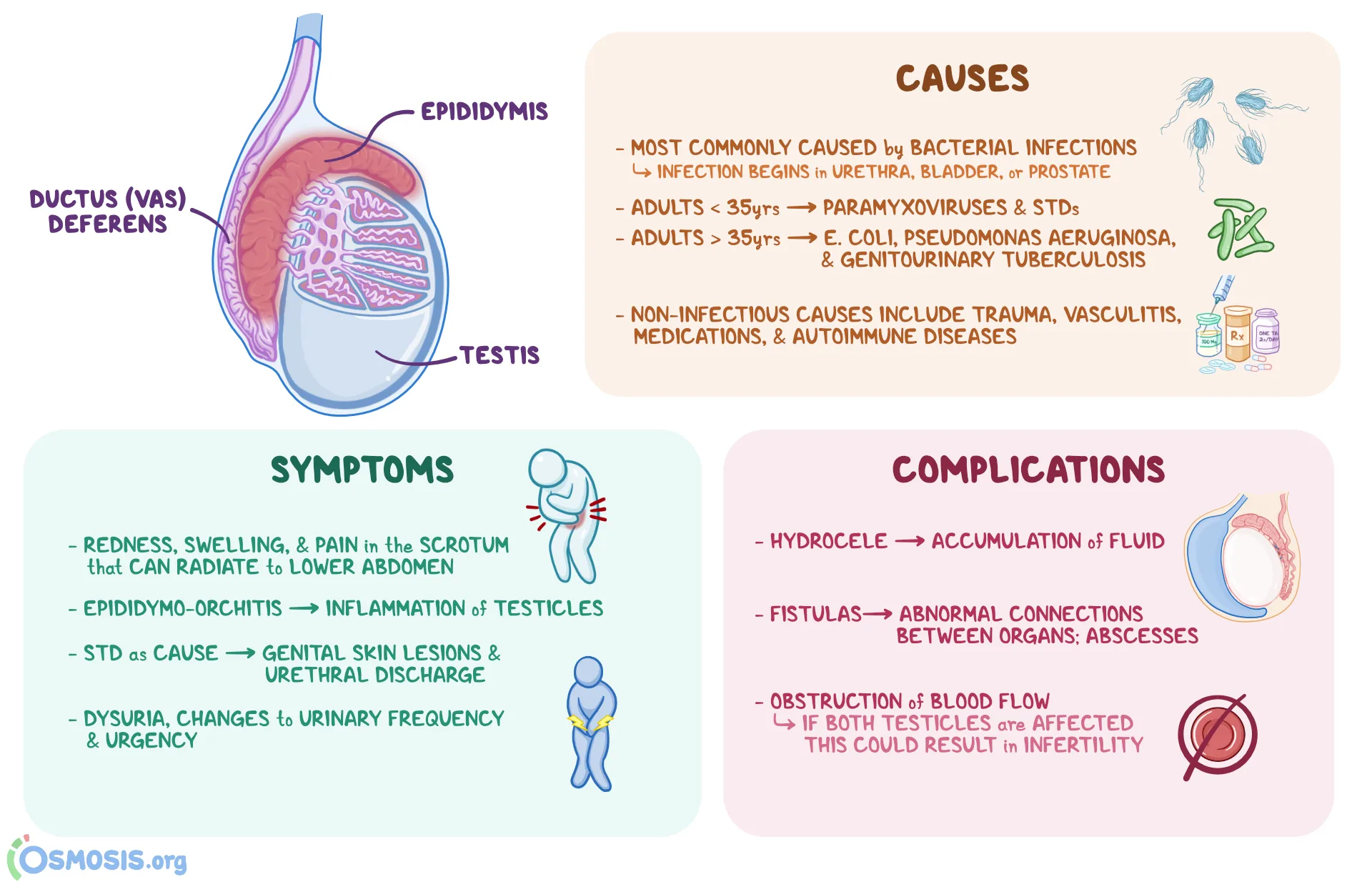 Epididymitis What Is It Symptoms Causes Diagnosis Treatment Osmosis