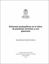 Esfuerzos Peripapilares En La Retina De Pacientes Normales Y Con Glaucoma