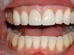 Facts About Teeth Dentist In Kent