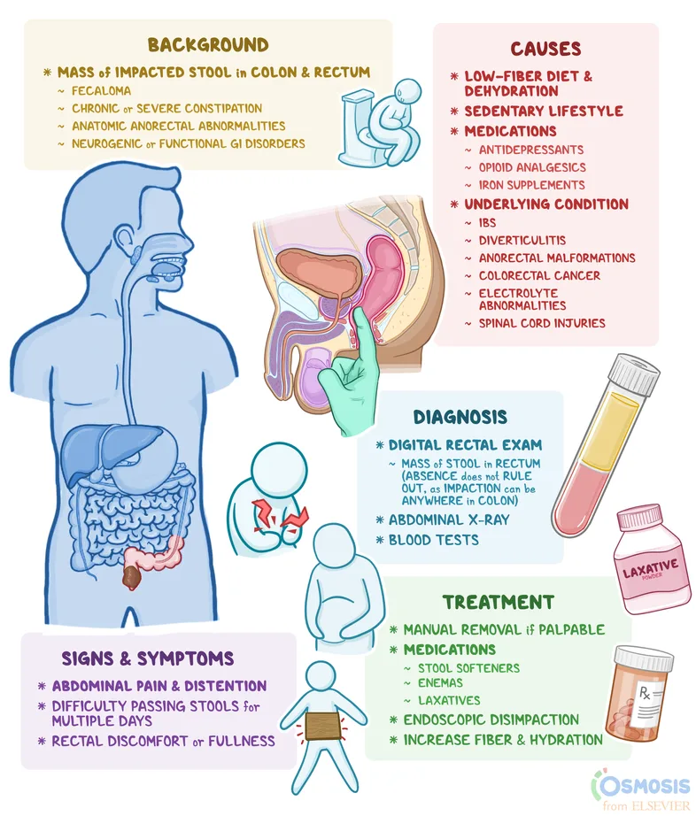Fecal Impaction What Is It Causes Treatment And More