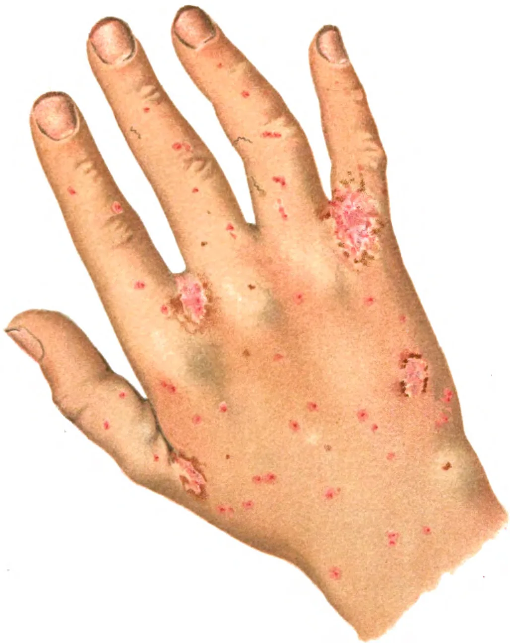 File An Introduction To Dermatology 1905 Wikimedia Commons