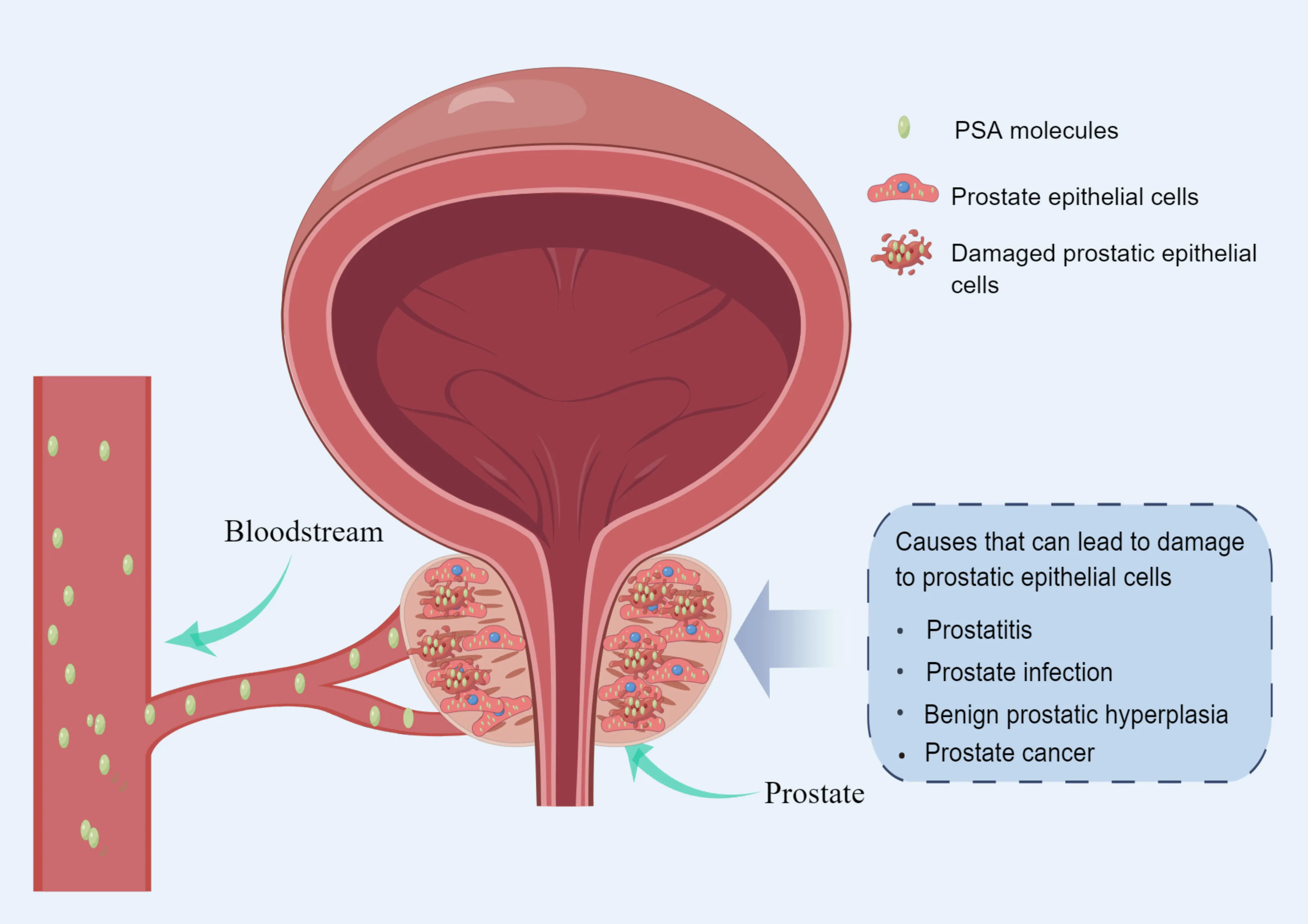 Frontiers Application And Optimization Of Prostate Specific Antigen Screening Strategy In The