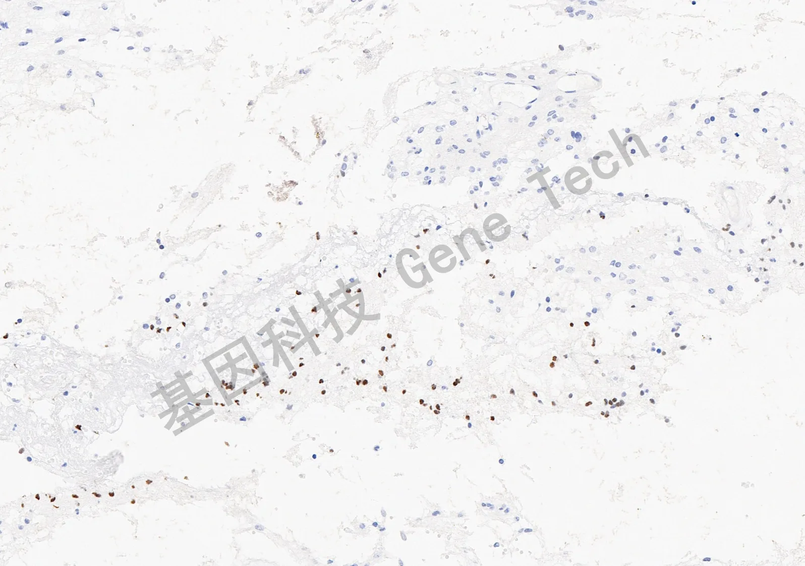H3 3G34R抗体试剂 免疫组织化学法