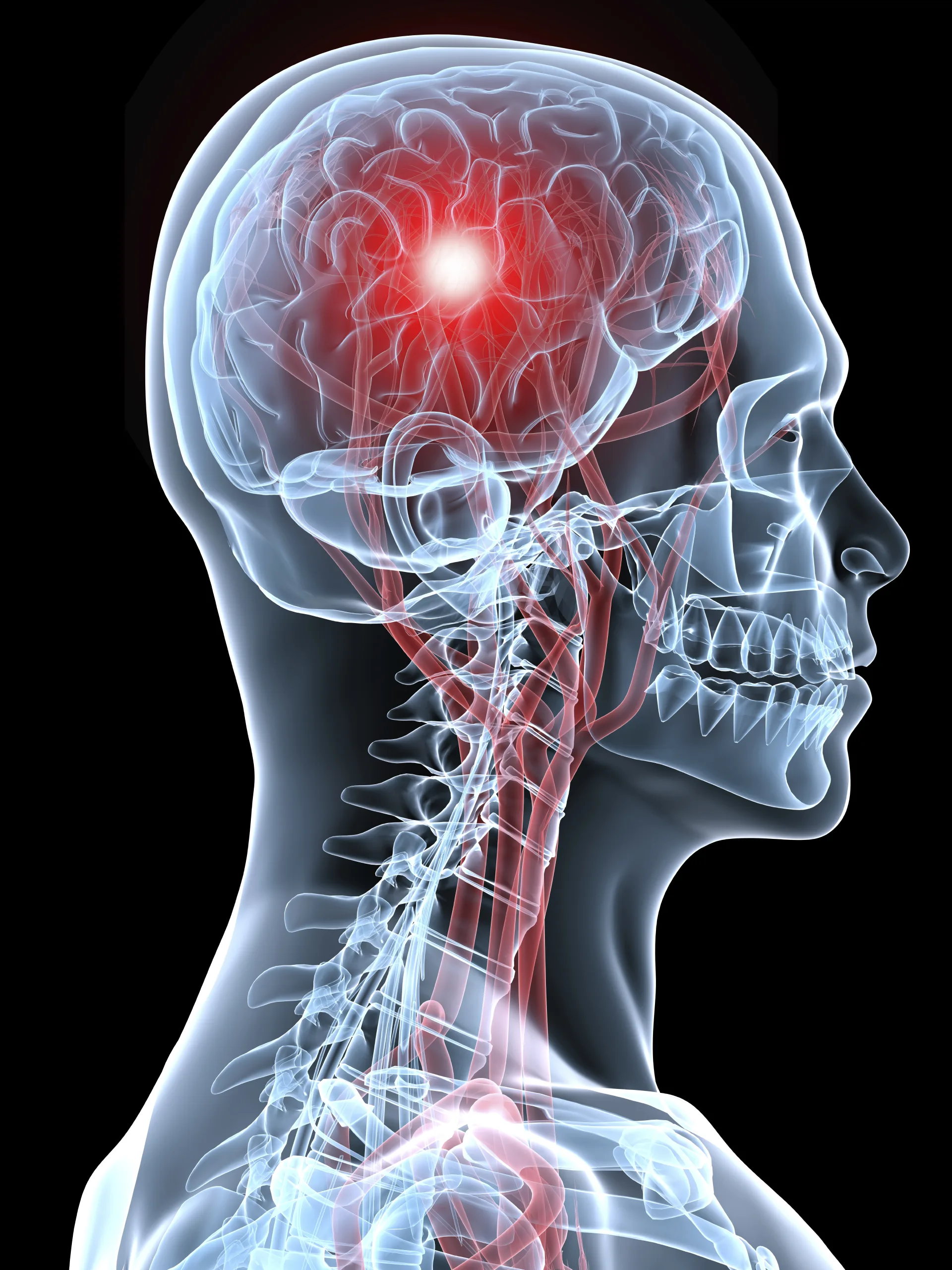 Health Tips Stroke Treatments Toxic Chemicals In Receipts And New Alcohol And Sugar Drink