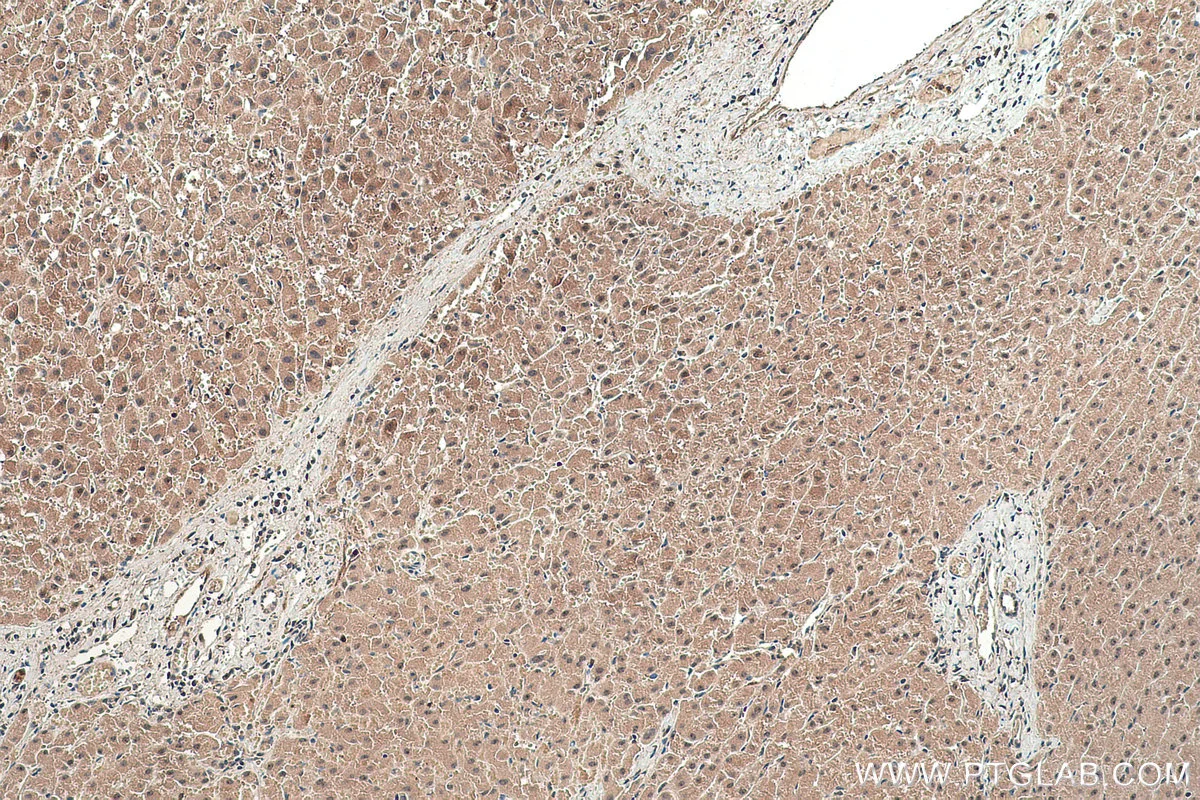Ihceasy Abhd14B Ready To Use Ihc Kit Khc0392 Proteintech 武汉三鹰生物技术有限公司