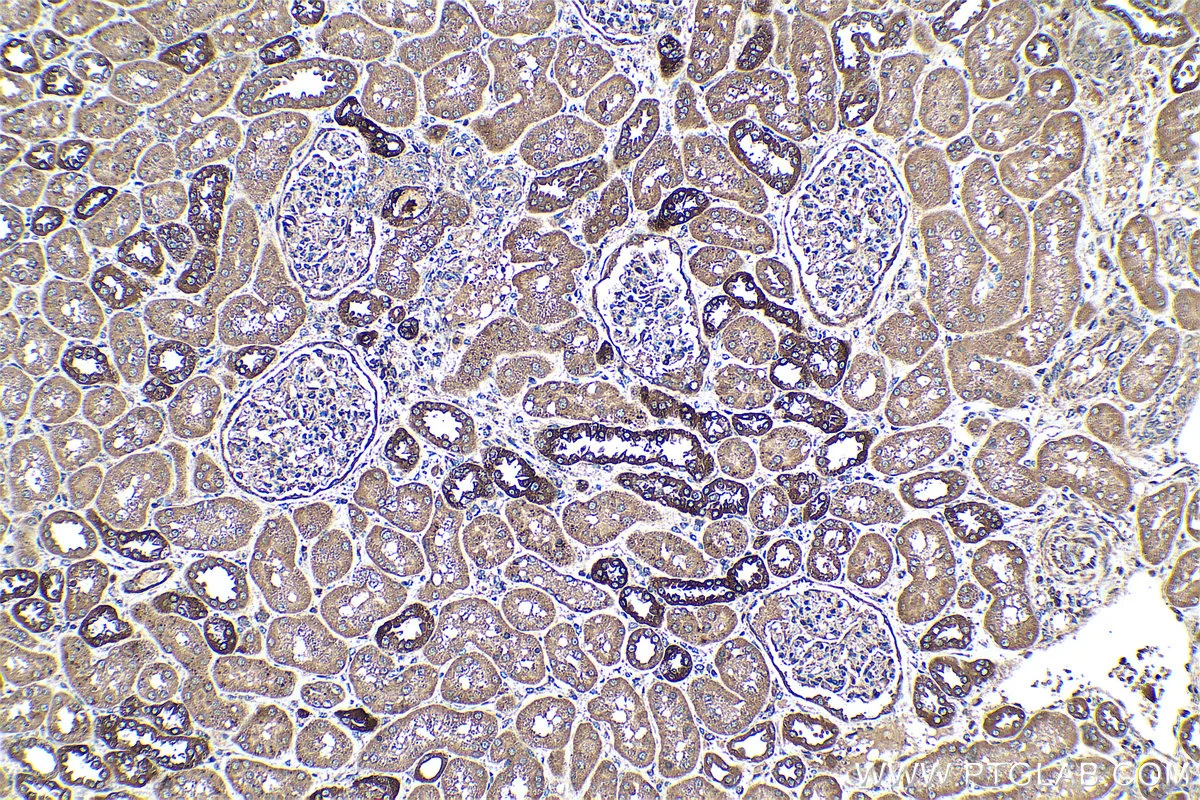 Ihceasy Acsl4 Ready To Use Ihc Kit Khc0474 Proteintech 武汉三鹰生物技术有限公司