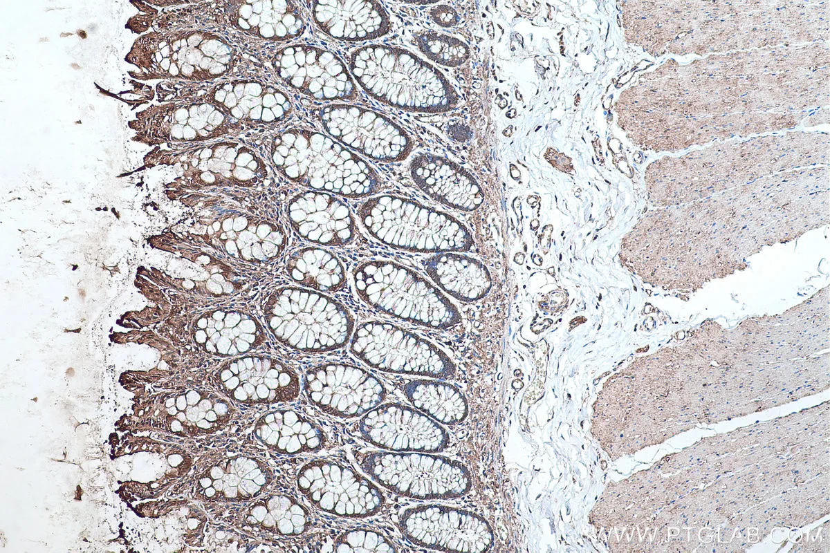 Ihceasy Aldoa Ready To Use Ihc Kit Khc0488 Proteintech 武汉三鹰生物技术有限公司