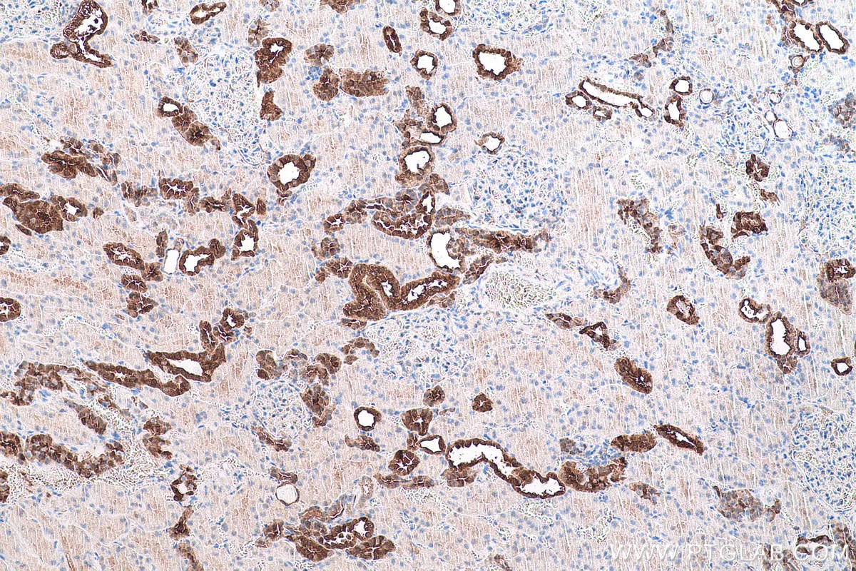 Ihceasy Gstm3 Ready To Use Ihc Kit Khc0789 Proteintech 武汉三鹰生物技术有限公司