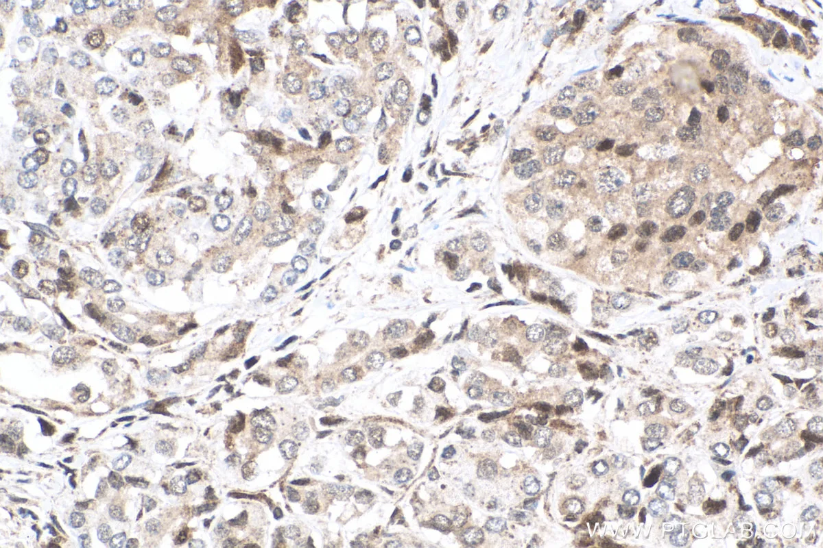 Ihceasy Hdac3 Ready To Use Ihc Kit Khc0614 Proteintech 武汉三鹰生物技术有限公司