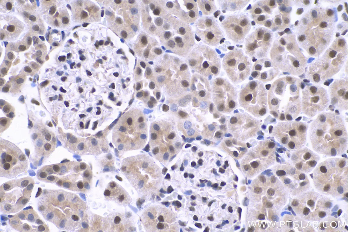 Ihceasy Hmgb1 Ready To Use Ihc Kit Khc0736 Proteintech 武汉三鹰生物技术有限公司