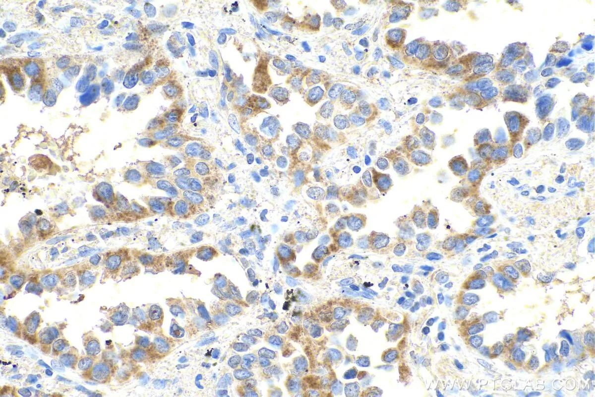 Ihceasy Mmp1 Ready To Use Ihc Kit Khc0804 Proteintech