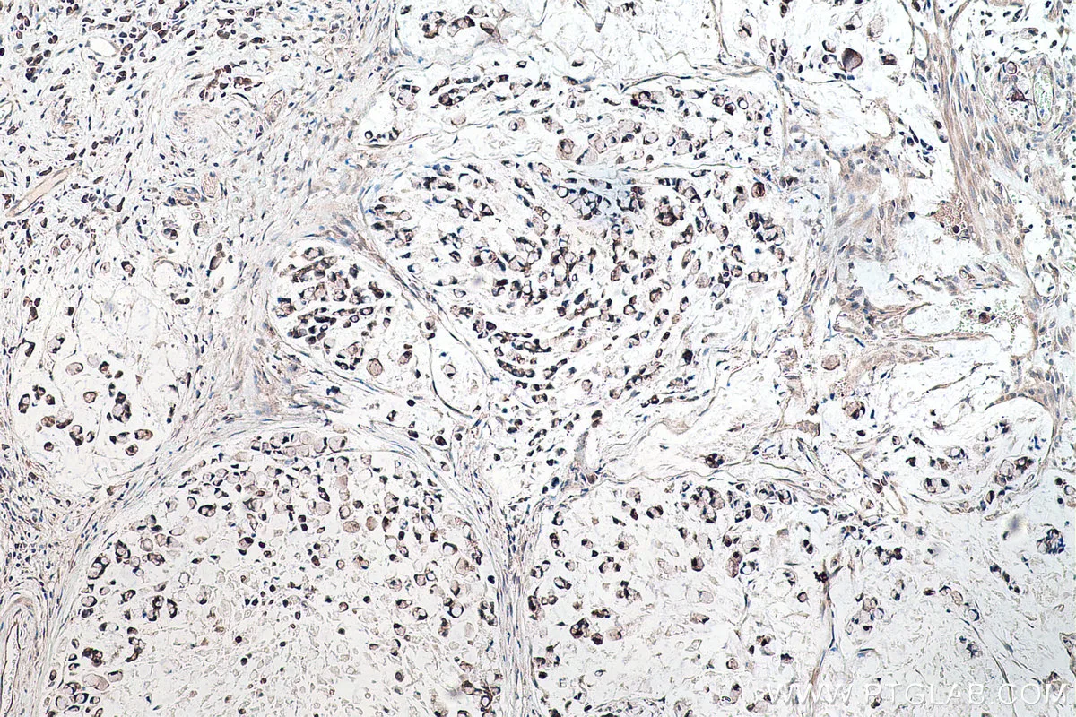 Ihceasy Nsun6 Ready To Use Ihc Kit Khc0173 Proteintech 武汉三鹰生物技术有限公司