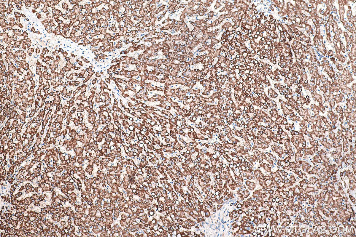 Ihceasy Ppif Ready To Use Ihc Kit Khc0447 Proteintech 武汉三鹰生物技术有限公司