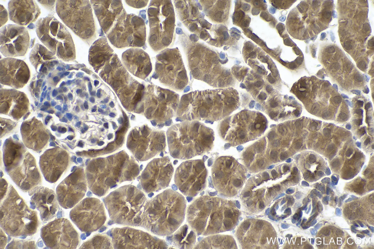 Ihceasy Psmd5 Ready To Use Ihc Kit Khc0858 Proteintech 武汉三鹰生物技术有限公司