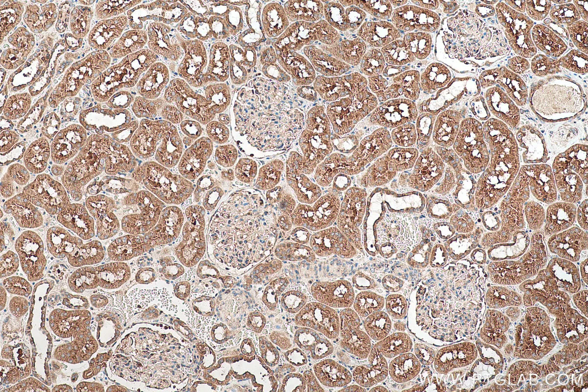 Ihceasy Sec31A Ready To Use Ihc Kit Khc0703 Proteintech 武汉三鹰生物技术有限公司