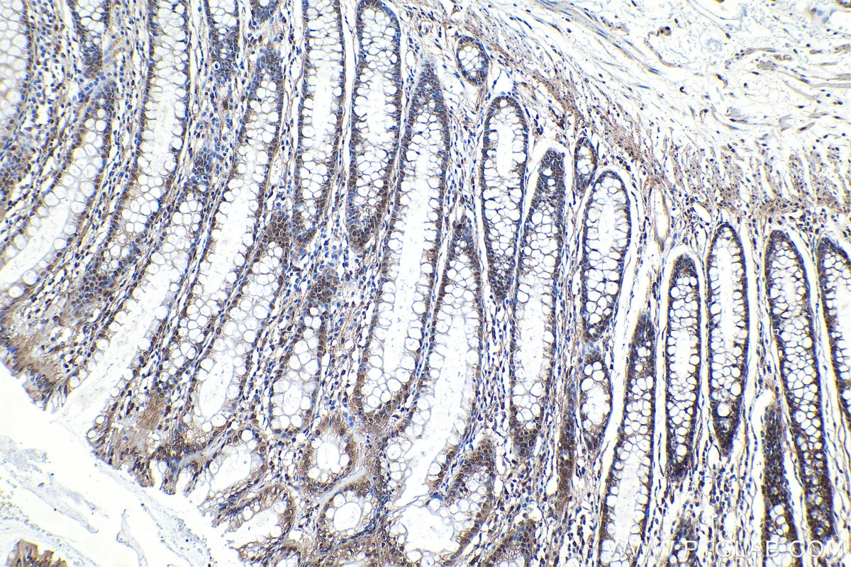 Ihceasy Stat6 Ready To Use Ihc Kit Khc1151 Proteintech 武汉三鹰生物技术有限公司