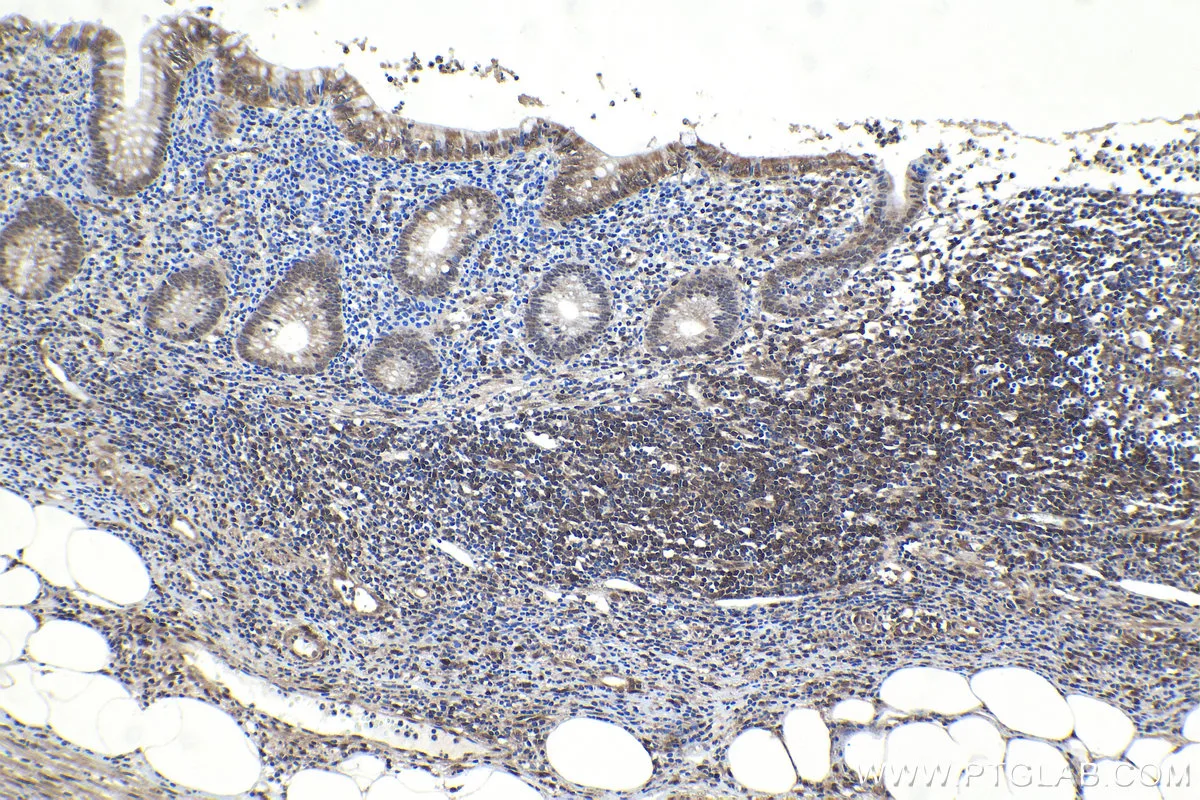 Ihceasy Stat6 Ready To Use Ihc Kit Khc1151 Proteintech 武汉三鹰生物技术有限公司