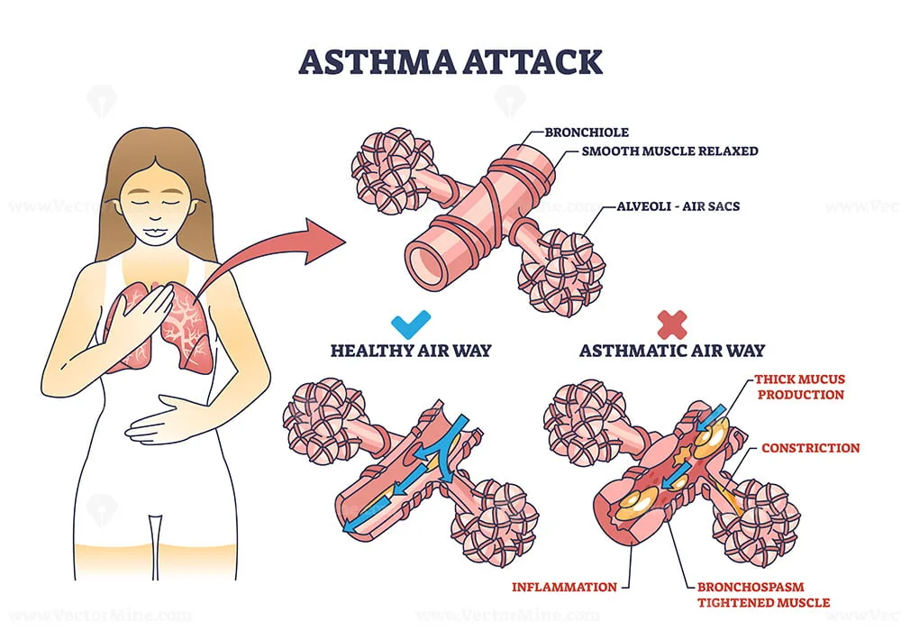 Is Air Conditioning Good Or Bad For Asthma At Zoe Walker Blog