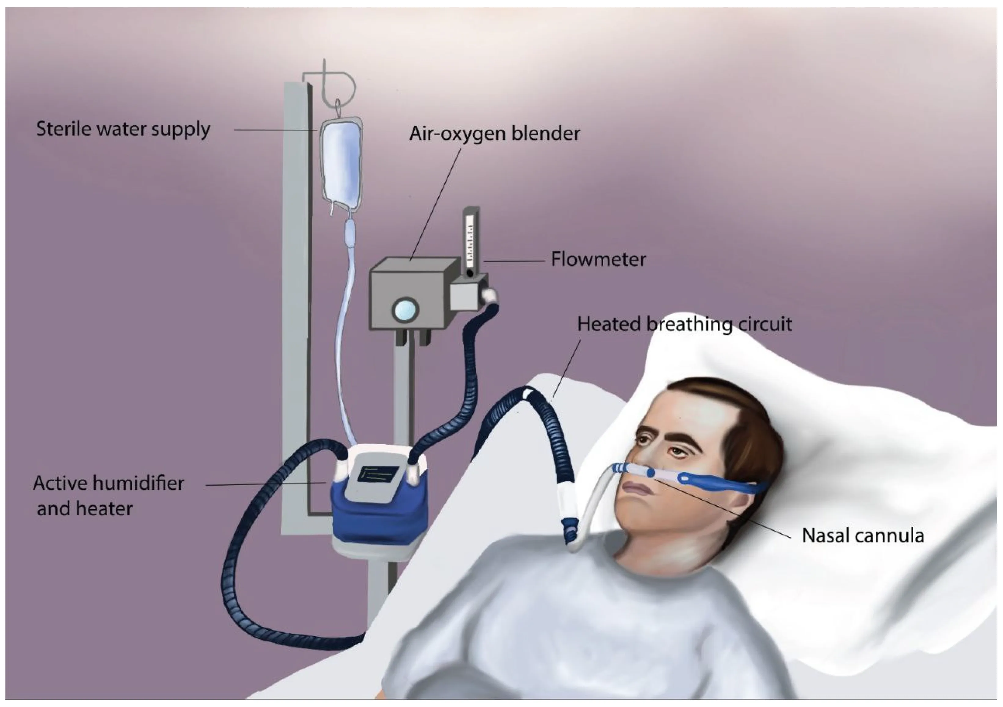 Jcm Free Full Text High Flow Oxygen Therapy In The Perioperative Setting And Procedural