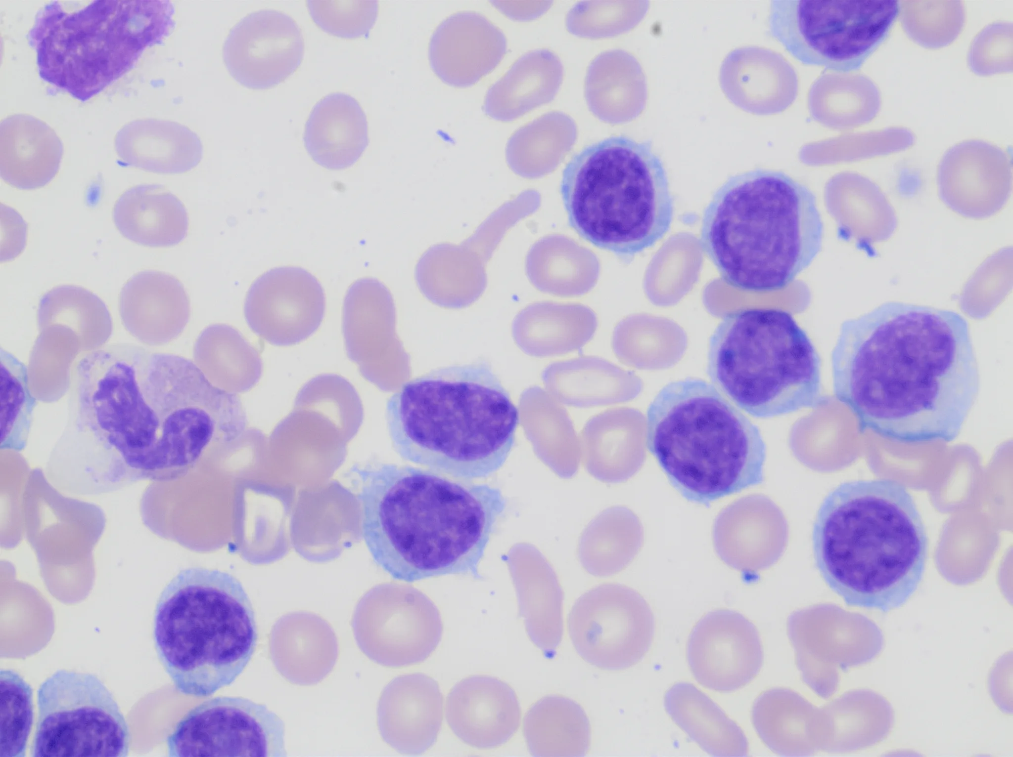 Lablogatory Page 62 A Blog For Medical Laboratory Professionals